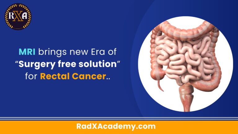 MRI brings new Era of Surgery free solution for Rectal Cancer